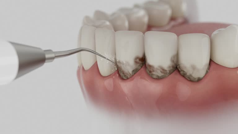 Reliable Dental Implants contractor in Andrews, NC by Smile Center Dentistry